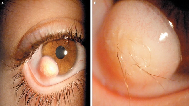 Hairy Eyeball.jpg